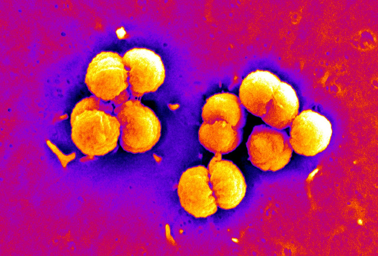 Two receptors and a scaffolding protein for the meningococcus to tightly adhere to human endothelial cells